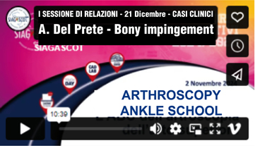 ADelPrete ankle